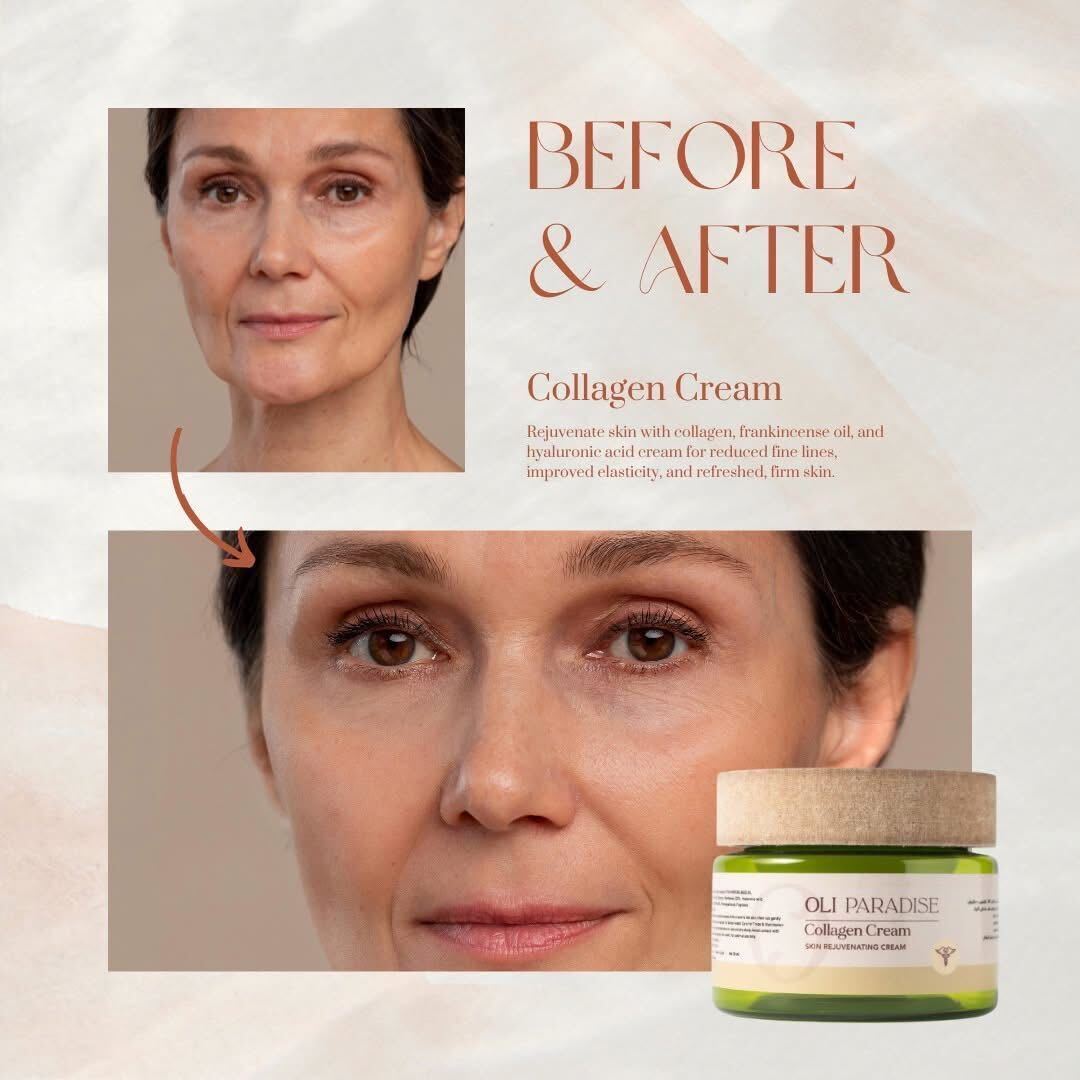 اولي باراديس كولاجين - الصورة 4